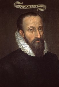 Ambroise Paré. siglo XVI