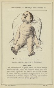 Actitud de un niño pequeño con convulsiones eclámpticas de French School