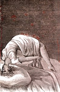 Histeria, trastorno mental y nervioso, derivado de una ansiedad intensa. 1887 (grabado) de French School