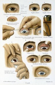 Medicina: el ojo de French School