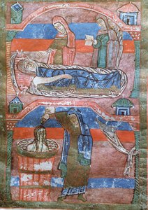 Ms 250 Mujer hidrópica curada por los baños de Santa Radegunda, de La vida de Santa Radegunda de French School
