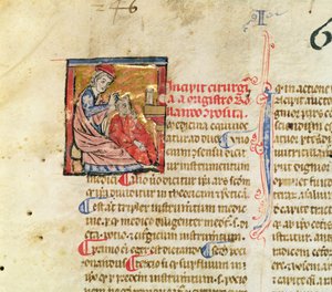 Ms Lat. 7134 fol.1 Trepanación, de Chirugie de Maitre Rolandi