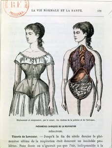 Los efectos nocivos del corsé, ilustración de La Vie Normale et la Santé por el Dr. Jules Rengade (n.1841) c.1880 de French School