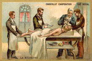 Trepanación