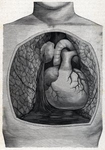 Ruptura de aneurisma, 1888 de French School
