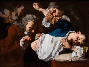 La operación, hacia 1753/54 (Óleo sobre lienzo) de Gaspare Traversi