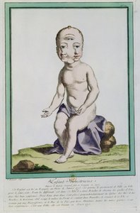 Niño con Cabeza Deformada, de 