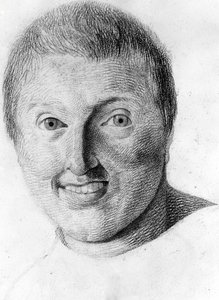 Un epiléptico, -en “Estudio de la fisionomía de los alienados”, dibujo de Gabriel de Georges Francois Gabriel