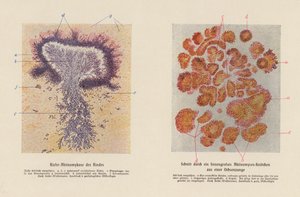 Actinomyces bovis (litografía en color)