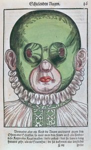 Máscara para tratar un estrabismo, de Ophthalmodouleia por Georg Bartisch (1535-1636) publicado en Dresde en 1583