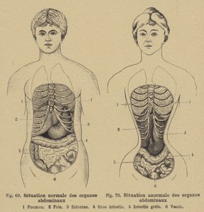 Situación normal de los órganos internos del abdomen en hombres y mujeres de German School