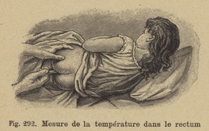 Tomando la temperatura de un niño por el recto