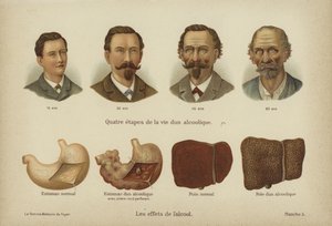 Los efectos del abuso del alcohol