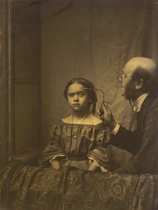 El músculo de la atención (izquierda); Contracción de la ceja debida a la luz brillante (derecha),1854-1856, impreso 1862 (foto)