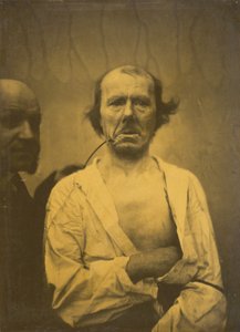 Una expresión relajada (izquierda); Disgusto (derecha) de Guillaume Benjamin Amant Duchenne