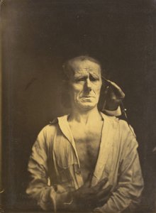 Espasmo del m. corrugador del ceño bajo luz muy fuerte (izquierda); Una cara relajada (fotografiada a plena luz del sol) (derecha) de Guillaume Benjamin Amant Duchenne
