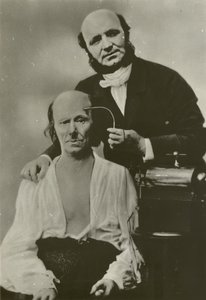 Neurólogo francés Duchenne de Boulogne usando su aparato de electrofisiología en un anciano de Guillaume Benjamin Armand Duchenne de Boulogne