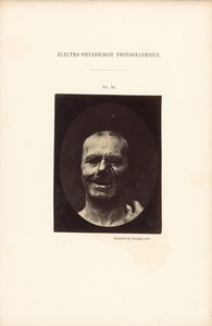 Electrofisiología fotográfica, Figura 53