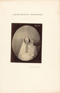 Electrofisiología fotográfica, Figura 76 de Guillaume Benjamin Duchenne