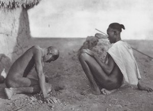África: Médico sangrando a un paciente (foto b/n)