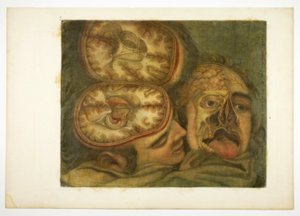 Disección craneal, lámina cinco de Anatomía de la cabeza, en Pinturas impresas de Jacques Fabien Gautier d