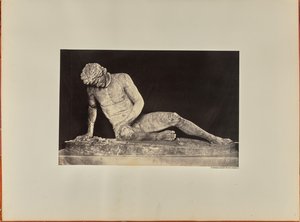 El Gladiador Moribundo, vista frontal (Capitolio)
