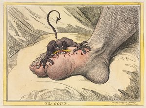 La gota, 1799