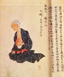 El primer tratamiento quirúrgico del cáncer de mama realizado bajo anestesia general por Seishu Hanaoka (1760-1836) en 1804 de Japanese School