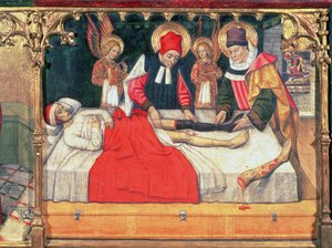 126-0035321 SS. Cosme y Damián injertan la pierna de un etíope en el muñón del diácono Justiniano; de Jaume Huguet