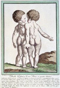 Niños siameses - en "Las desviaciones de la naturaleza" de Régnault de Jean Baptiste Regnault