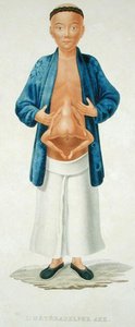 Hombre chino con un gemelo unido no desarrollado en su abdomen, ilustración de un libro de viajes francés, grabado por M. Legrand de Jean Gabriel (after) Pretre