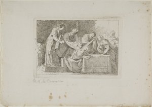 Circuncisión