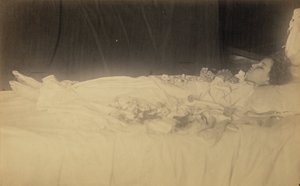 [Estudio de un niño muerto]