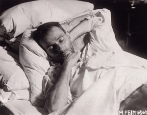 Egon Schiele en su lecho de muerte, 1918