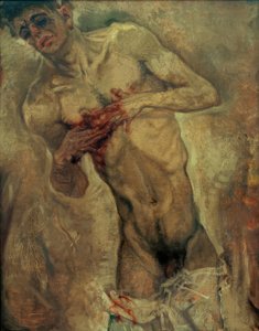 El hombre sangrante