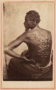 La espalda flagelada,c. 1863 (foto) de McPherson & Oliver