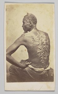 Gordon bajo inspección médica, 1863 de McPherson and Oliver