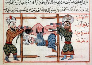 Reducción de una fractura. Miniatura de un tratado de medicina turca por Sharaf al-din de Ottoman School