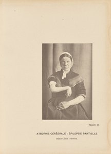 Atrofia Cerebral: Epilepsia Parcial Hemiplejia Derecha de Paul Marie Léon Regnard