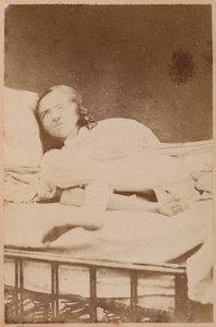 Epilepsia histérica, contorsiones, lámina XXXVIII de 
