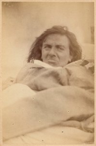 Epilepsia histérica, alucinaciones, repugnancia, lámina XXXV de 