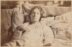 Epilepsia histérica, fase terminal, delirio melancólico, ilustración de 
