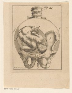 Feto en el útero
Impresiones médicas sobre el embarazo y el parto (título de la serie) de Philibert Bouttats (II)