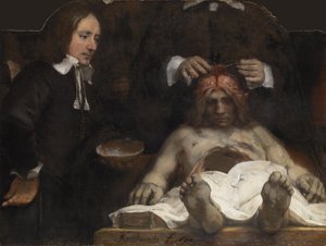 La lección de anatomía del Dr. Jan Deyman, 1656 de Rembrandt van Rijn