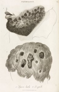Dermatología Enfermedades de la piel de John Pardon