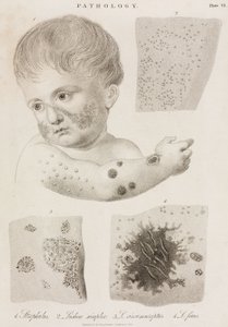 Dermatología Tipos de enfermedades de la piel de John Pardon