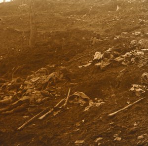 Después del ataque, Les Éparges, norte de Francia, 1915 de Unbekannt
