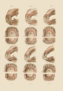 Descripción de la placa que muestra la edad, según lo indicado por los dientes, c1879