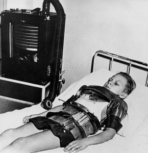 Niño de once años en un pulmón de acero, Hospital Beaujon, París, c1947-1951