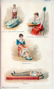 Tratamientos de hidroterapia, c. 1902 de Unbekannt